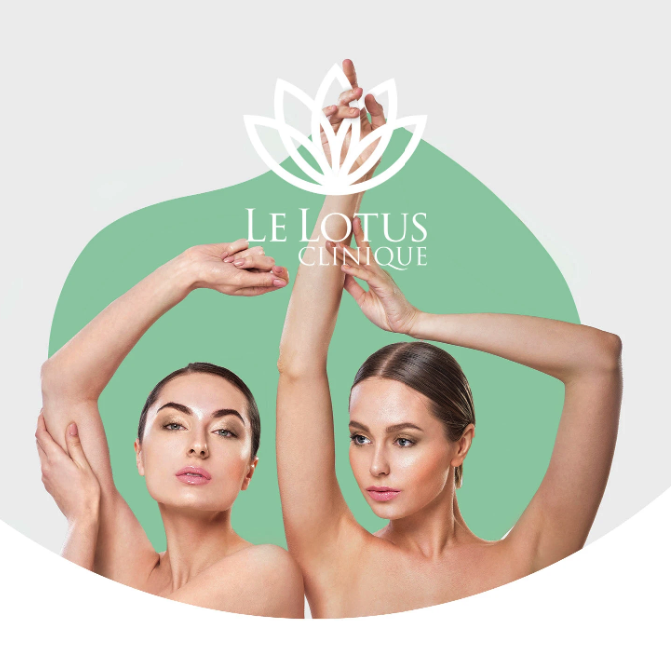 Le Lotus Performance Visual